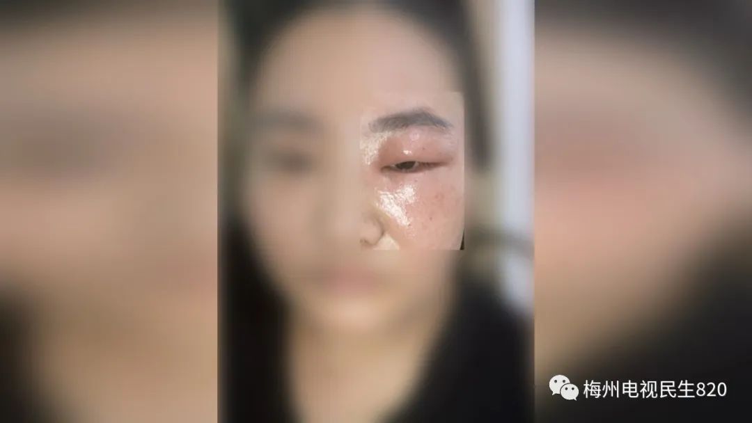 有人在闹市区养蜂？已有店主眼睛被蛰，肿了一张脸休闲区蓝鸢梦想 - Www.slyday.coM