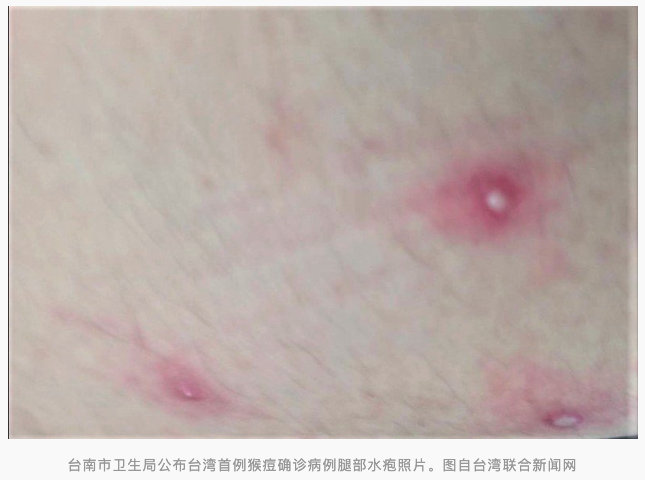 图片慎点休闲区蓝鸢梦想 - Www.slyday.coM 图片慎点休闲区蓝鸢梦想 - Www.slyday.coM