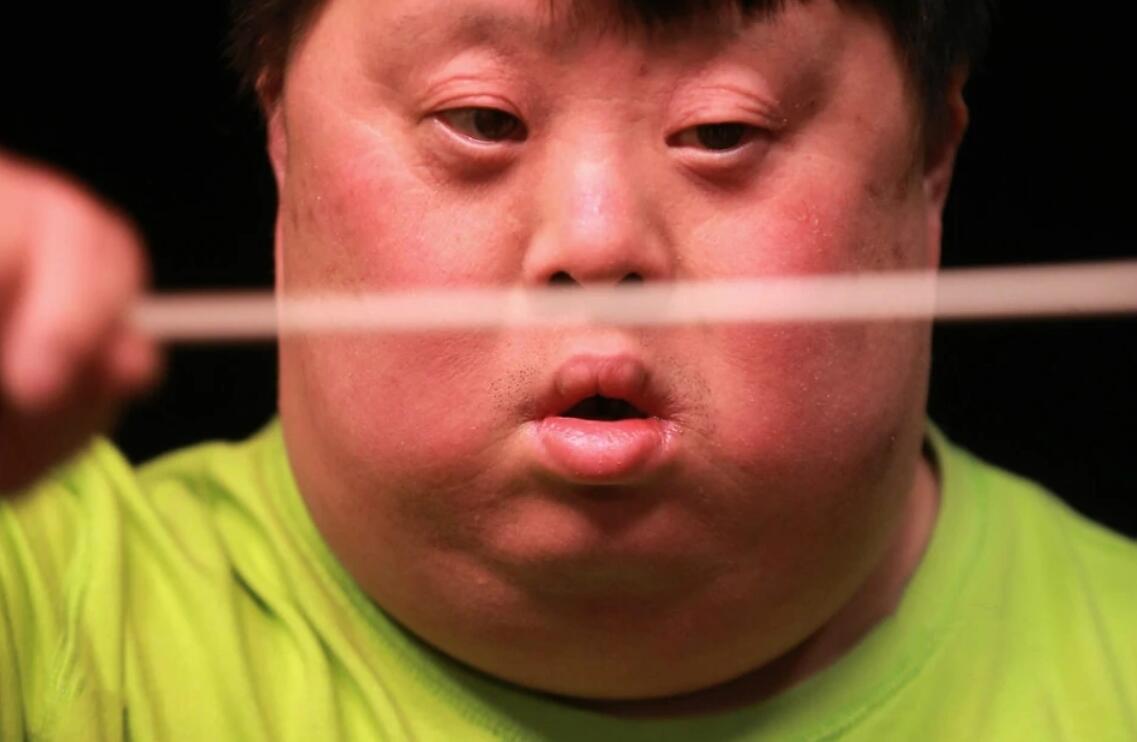 其实,还有一位天生智力残缺的胡一舟,那么,胡一舟是如何逆袭人生,成为