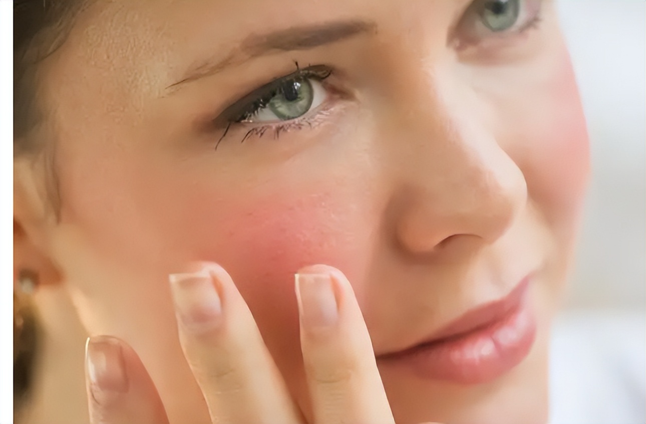 夏天容易脸红教你3个改善红脸蛋的技巧简单有效值得收藏