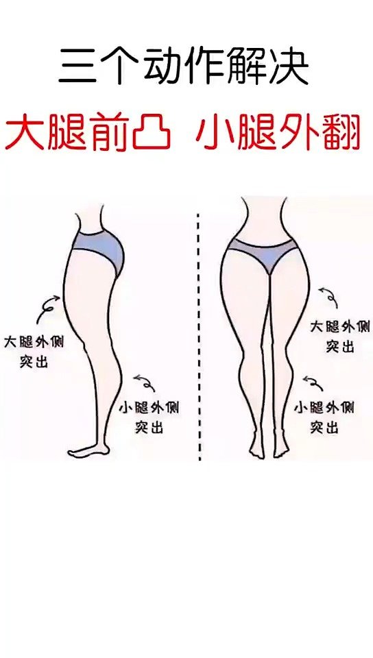 三个动作解决大腿前凸小腿外翻