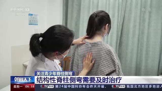 我国中小学生脊柱侧弯人数预计超500万休闲区蓝鸢梦想 - Www.slyday.coM