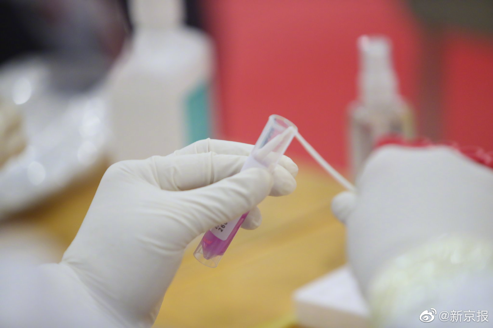 北京昨日新增1例本土无症状 在朝阳区休闲区蓝鸢梦想 - Www.slyday.coM