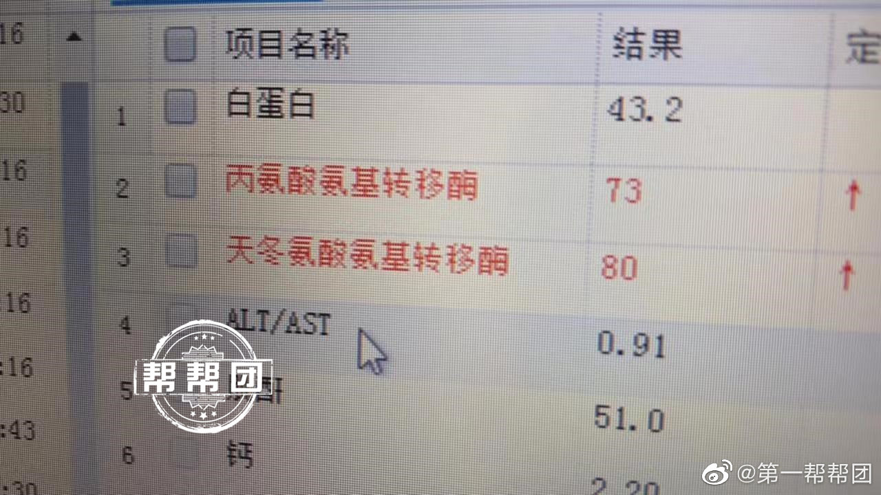 福州一对夫妇食用织纹螺，双双食物中毒休闲区蓝鸢梦想 - Www.slyday.coM