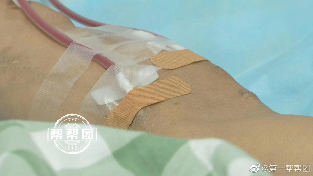 福州一对夫妇食用织纹螺，双双食物中毒休闲区蓝鸢梦想 - Www.slyday.coM