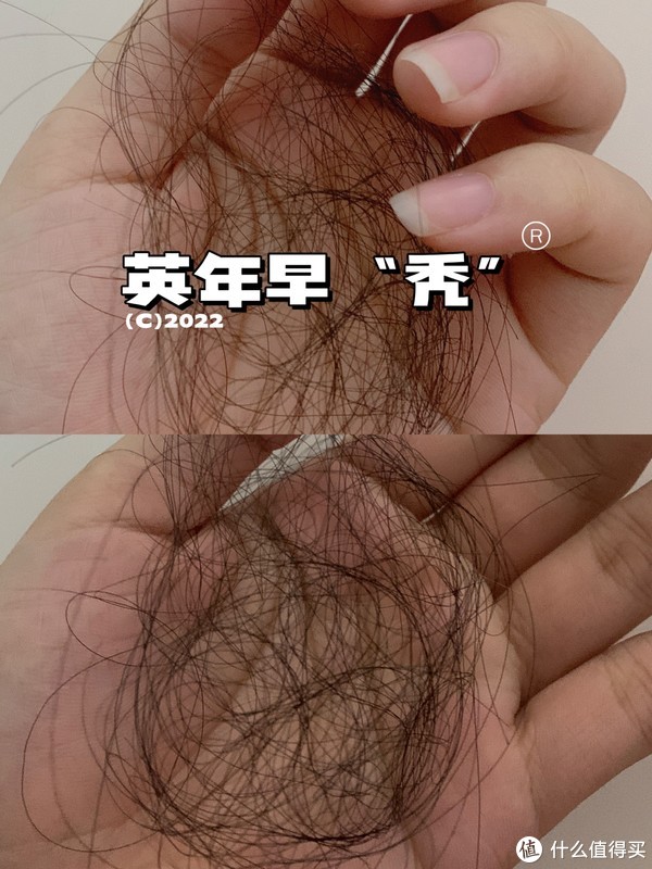 00后已经有脱发危机了吗 ️  “网红”生发液真的不是智商税吗？休闲区蓝鸢梦想 - Www.slyday.coM