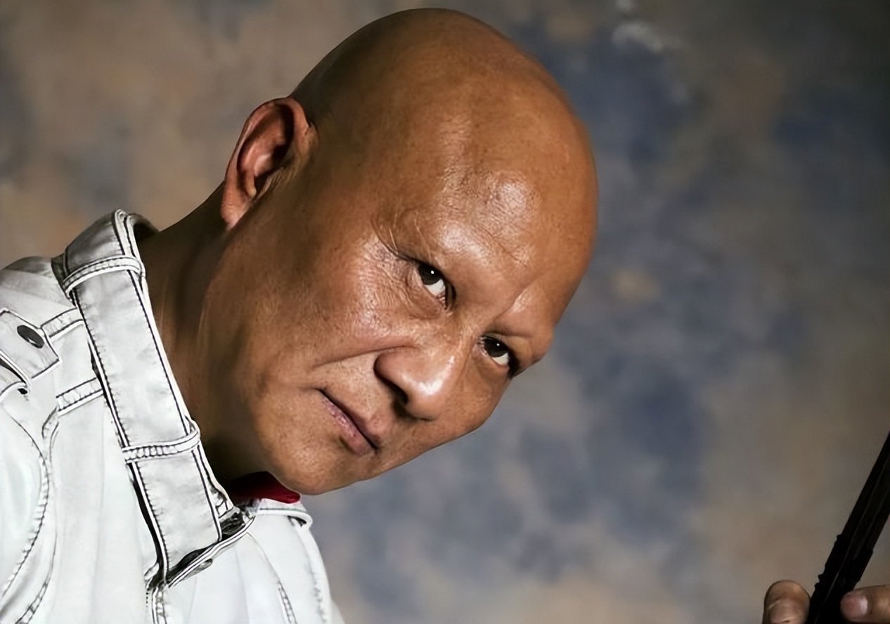 国宝级“反派”计春华:18岁因毁容当演员,他的牺牲远比你想得大休闲区蓝鸢梦想 - Www.slyday.coM 国宝级“反派”计春华:18岁因毁容当演员,他的牺牲远比你想得大休闲区蓝鸢梦想 - Www.slyday.coM