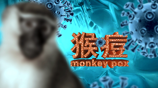 新冠未平，猴痘又起？来听感染专家王新宇讲述猴痘的前世今生休闲区蓝鸢梦想 - Www.slyday.coM