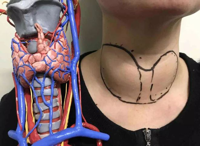 找对病根是关键!|体质|甲亢|甲状腺_新浪新闻