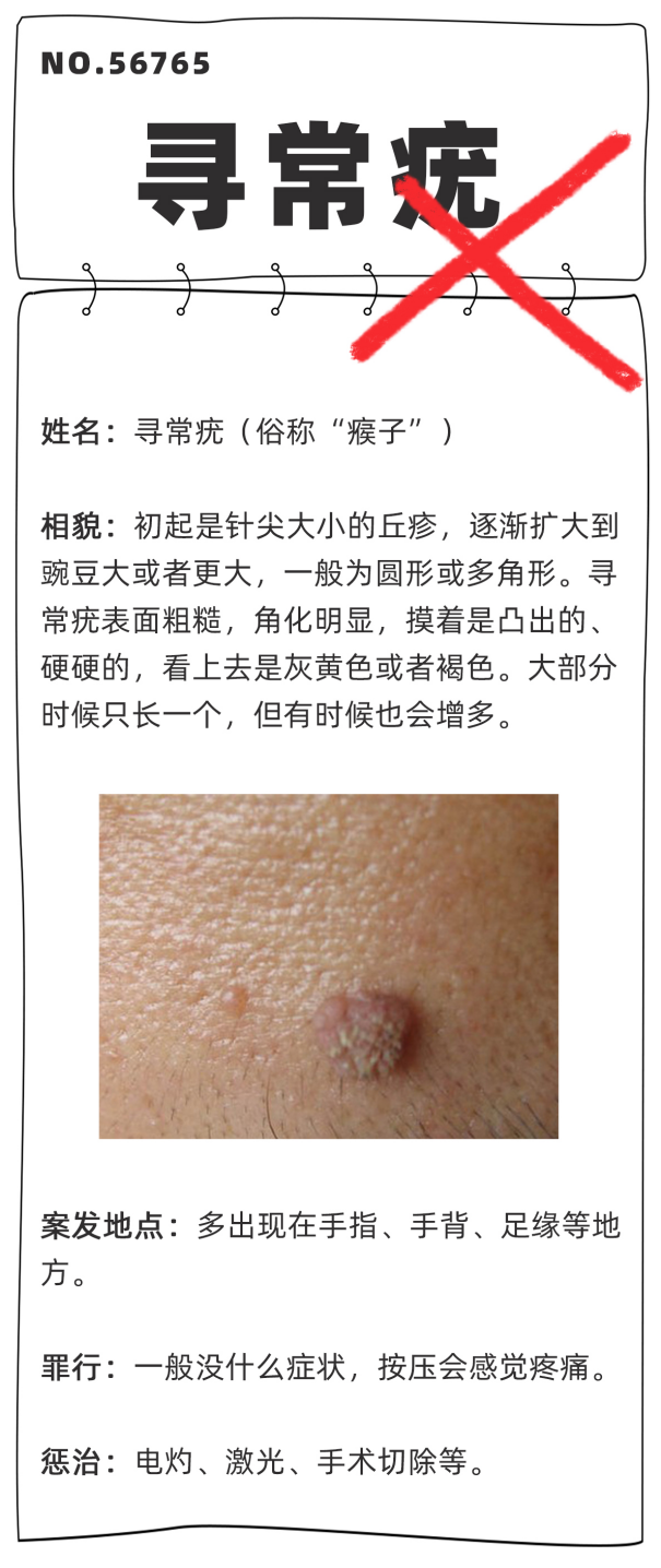 请问杜一生的药为什么那么贵？