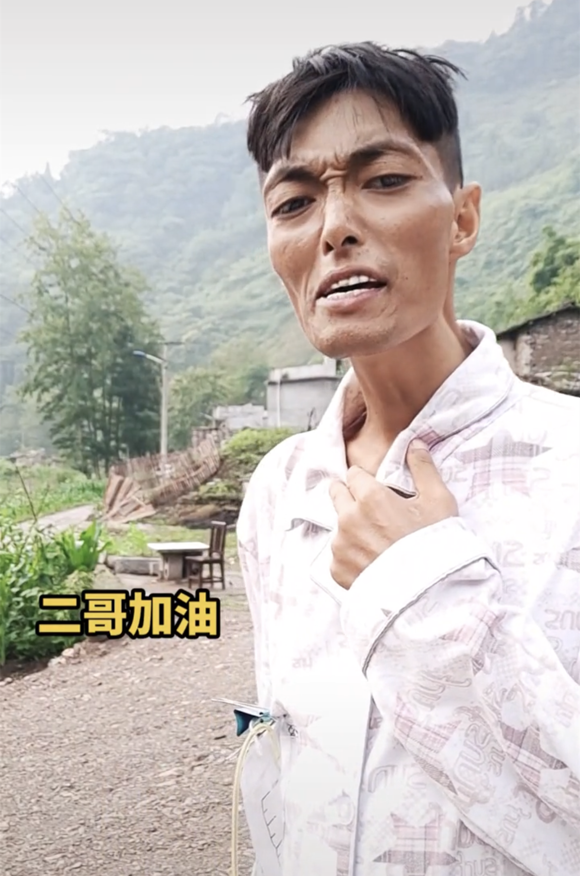 一路走好34岁网红长安二哥因肝癌去世前后不到半年瘦到皮包骨