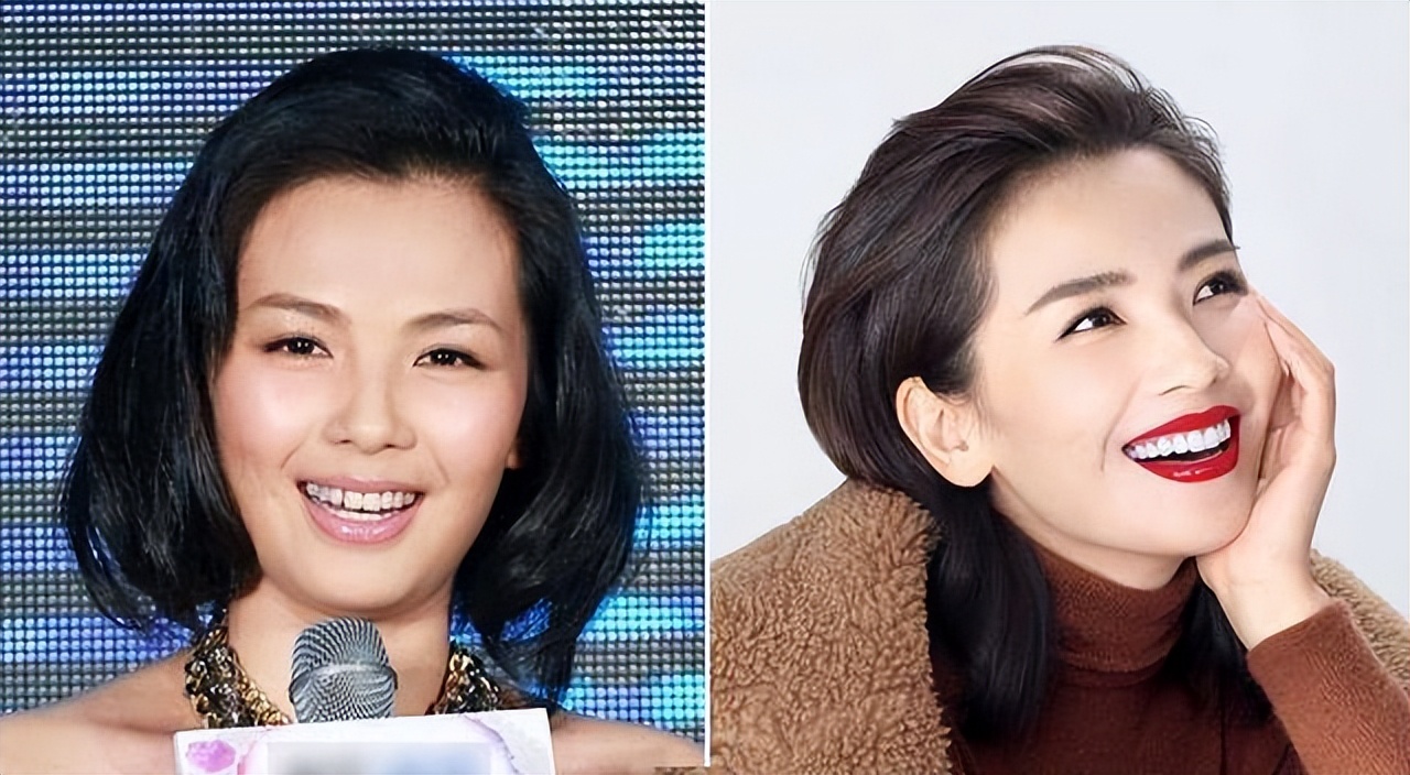 "森白牙,高山鼻,刀削脸",演艺圈的明星,真是把脸玩"透"了