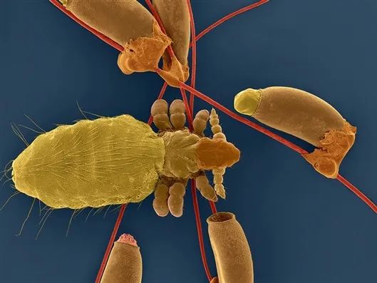 当时的哺乳动物可能很幸福,因为它们的身上没有虱子