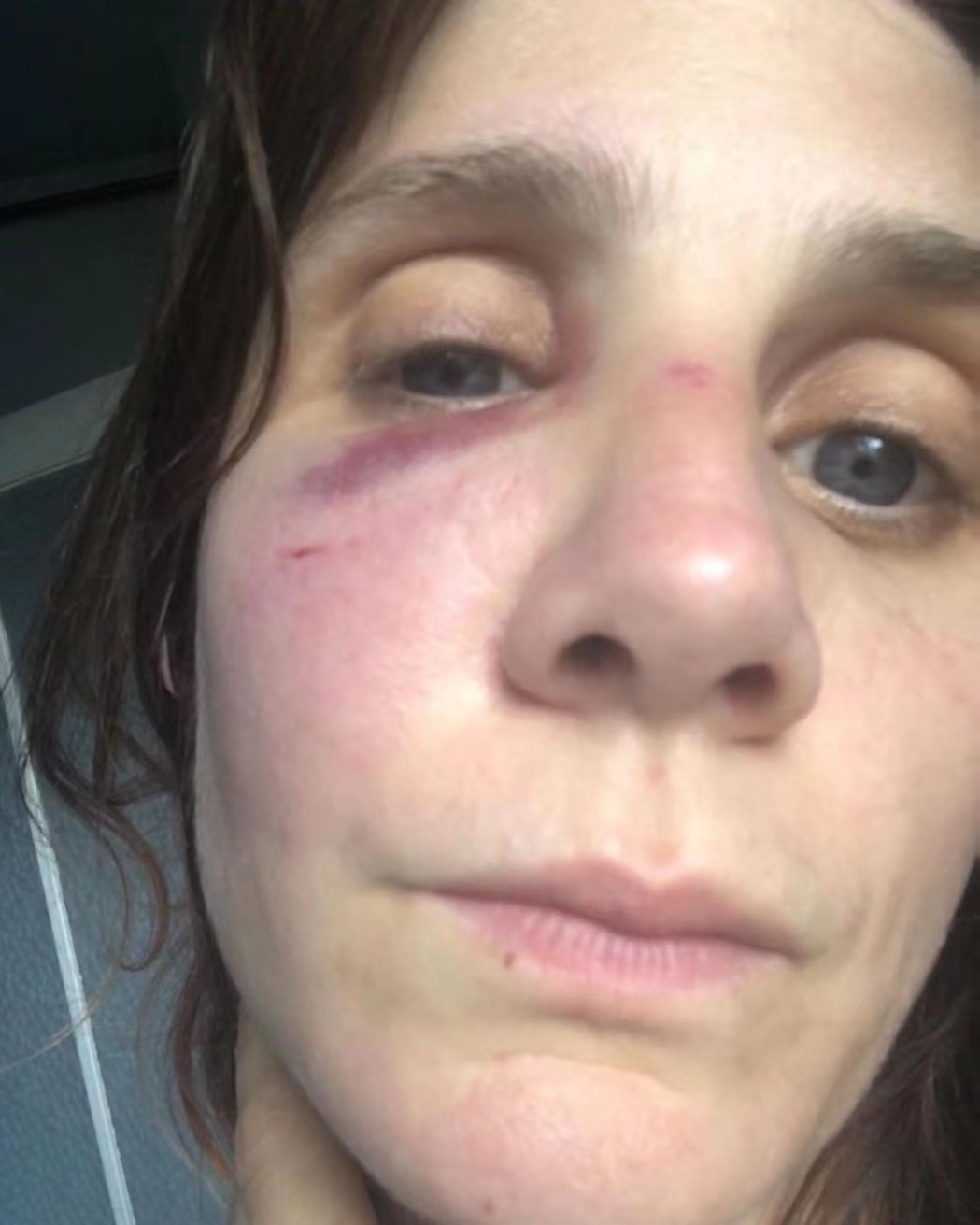 法国女星遭导演前男友家暴,社交平台曝光伤照,脸部青肿让人心疼