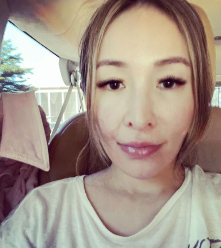 萧亚轩晒全素颜照狗咬伤痕依旧可见网友在意你喜欢的人就好