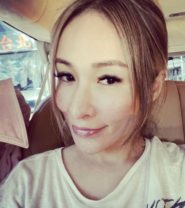 萧亚轩晒全素颜照狗咬伤痕依旧可见网友在意你喜欢的人就好