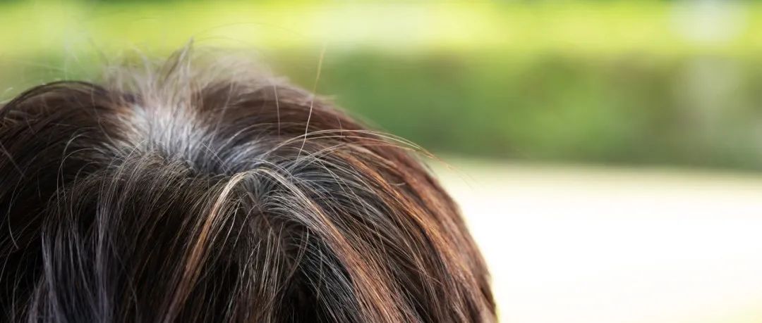 白发突然增多是老了吗?注意!可能是身体缺这4种营养…|维生素_新浪新闻