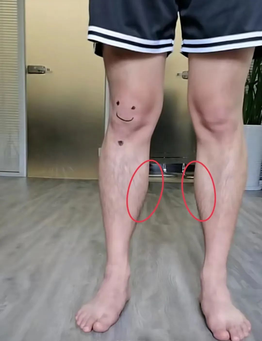 虽然确实靠脸力压过天仙 但她这次的上衣卡裆造型真是尬穿地心吧 O型腿 足弓 膝盖 新浪新闻