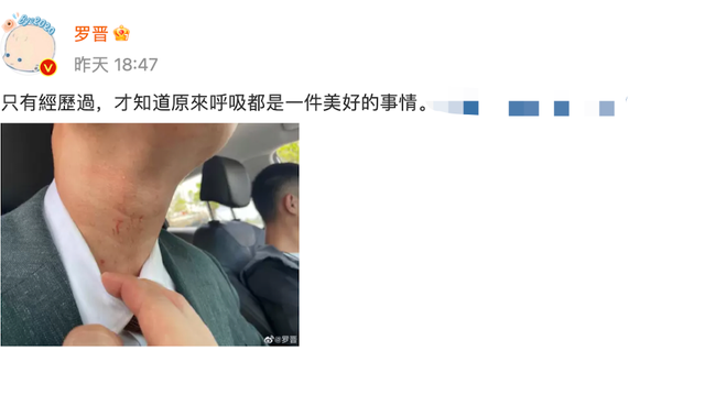 演员罗晋拍戏被勒脖子到窒息！青筋暴起眼球充血，脖子上伤痕明显休闲区蓝鸢梦想 - Www.slyday.coM
