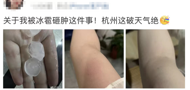 “第一次见这么大的！”杭州下起冰雹，有人被砸肿！台风、降温都要来了？休闲区蓝鸢梦想 - Www.slyday.coM