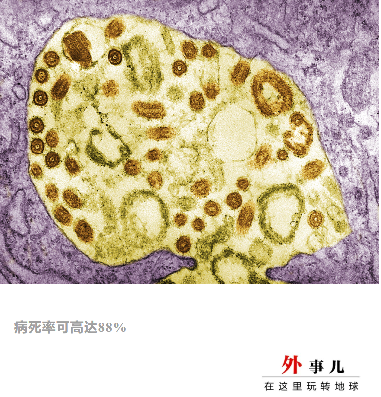 加纳又报告2例 什么是马尔堡病毒？