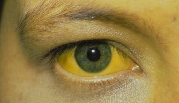 肝病来袭，身体常会出现3种症状！这一种水果，拜托不要再吃休闲区蓝鸢梦想 - Www.slyday.coM