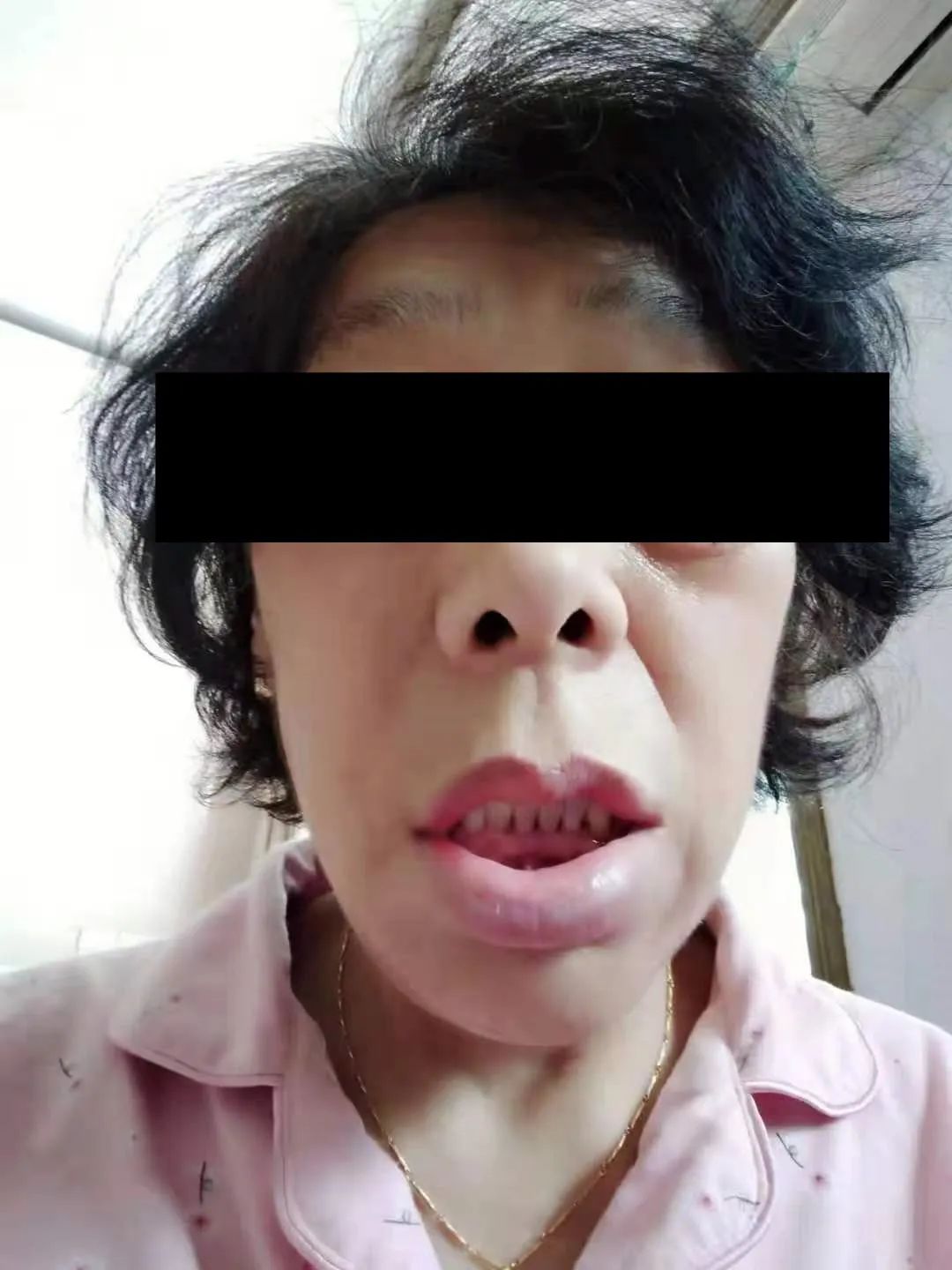西安大妈声音变粗,四肢变大 像个"男人" 竟是这个