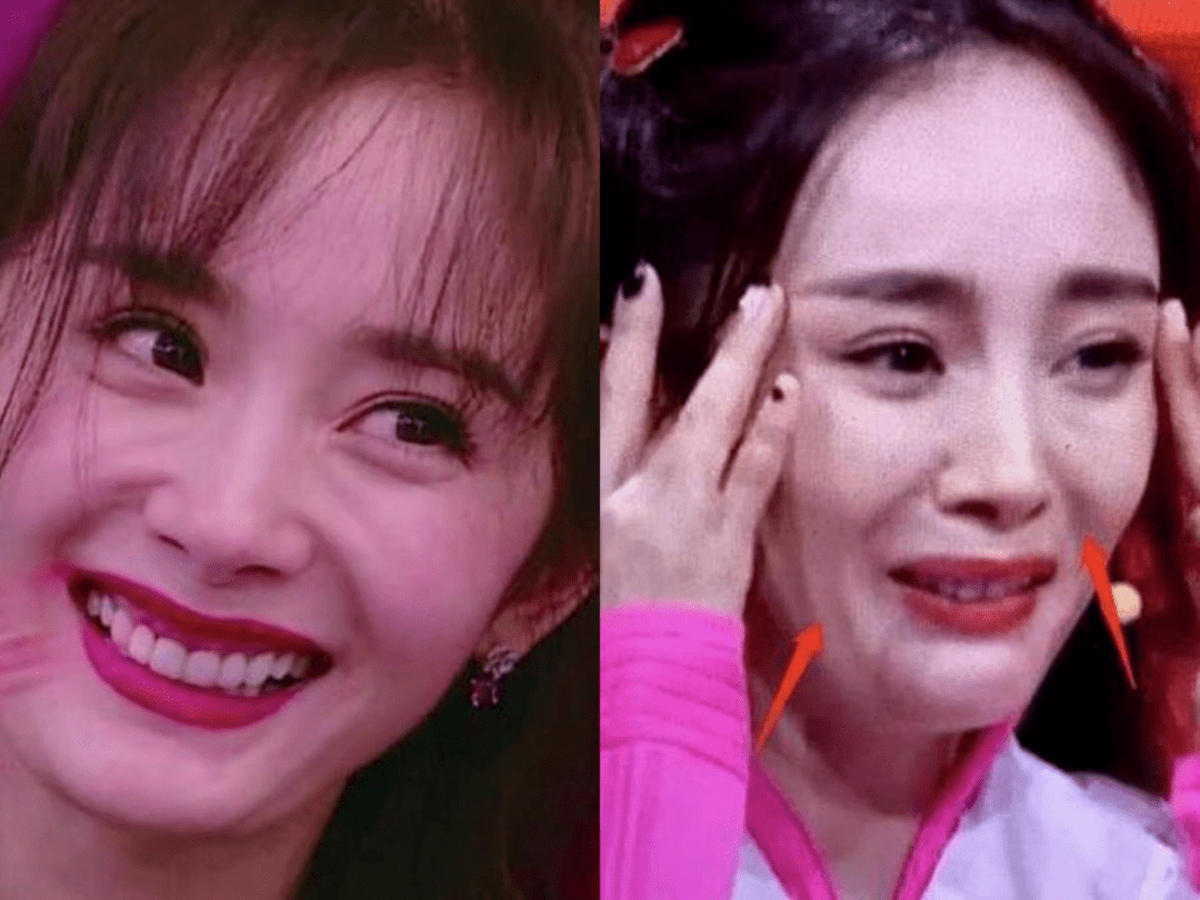 娱乐圈最令人窒息的一刀削骨脸从杨幂到鞠婧祎崩得没法看脸型脸蛋感觉