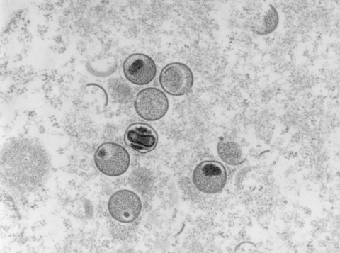 显微镜下的猴痘病毒。（资料图）