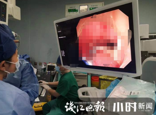 吃饭时真的不要笑！一女子连跑4家医院才搞定：吃尽苦头啊休闲区蓝鸢梦想 - Www.slyday.coM