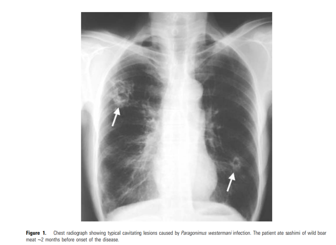 一口生腌，能吃到几条寄生虫休闲区蓝鸢梦想 - Www.slyday.coM
