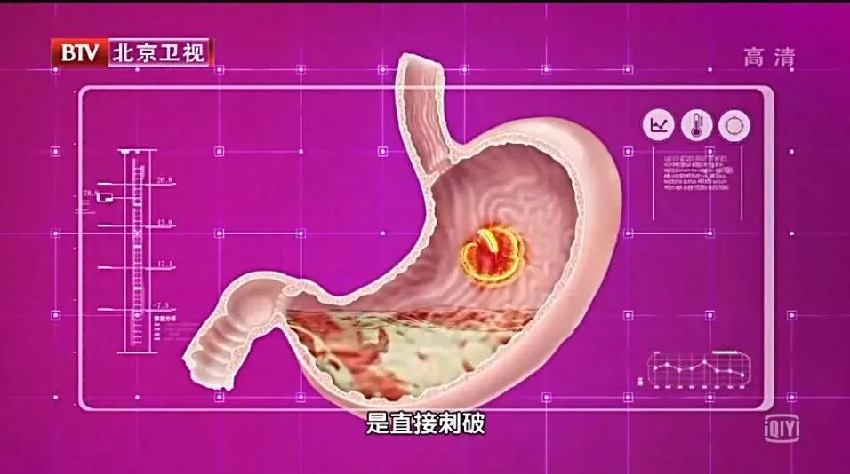 快停下！这些常吃的食物都是癌细胞的“帮凶”！每多吃一口都在伤害你！休闲区蓝鸢梦想 - Www.slyday.coM