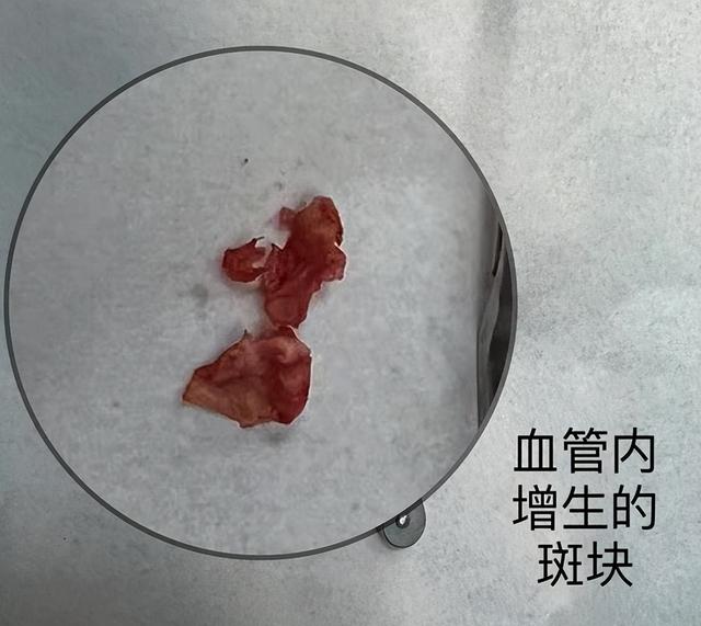 中老年人尤其要注意！黑朦不一定是眼病，可能是大脑在求救休闲区蓝鸢梦想 - Www.slyday.coM