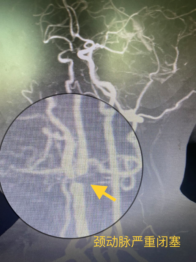 中老年人尤其要注意！黑朦不一定是眼病，可能是大脑在求救休闲区蓝鸢梦想 - Www.slyday.coM