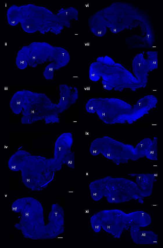 《自然》重磅突破！这枚人造胚胎，长出了完整大脑结构，还有一颗跳动的心脏休闲区蓝鸢梦想 - Www.slyday.coM