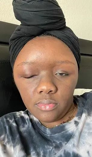 她才后知后觉:过去一年里她其实一直在过敏…自从用了这款染发膏之后