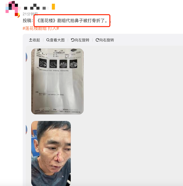 《莲花楼》剧组人员殴打代拍！对方鼻子骨折满脸血，场面暴力吓人休闲区蓝鸢梦想 - Www.slyday.coM