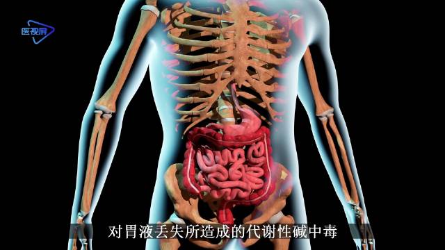 代谢性碱中毒的处理原则|火锅|奶茶_新浪新闻