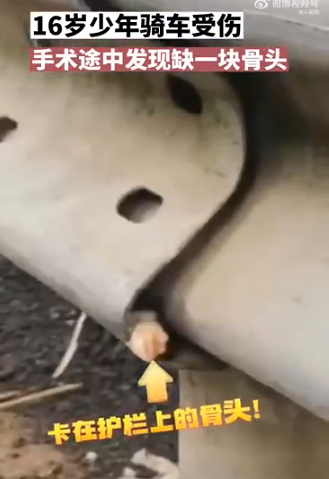 16岁少年上手术台发现少一块骨头，民警帮找回，全程仅用40分钟！休闲区蓝鸢梦想 - Www.slyday.coM