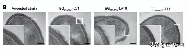 肠道细菌的脱逃会伴随慢性炎症导致微生物过度渗透称作“肠漏”休闲区蓝鸢梦想 - Www.slyday.coM