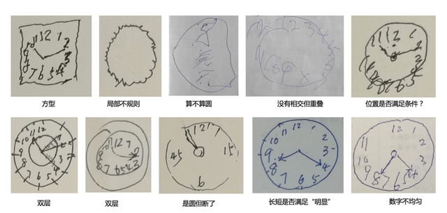 首个阿尔茨海默病AI筛查小程序上线，老人可十分钟自测患病风险