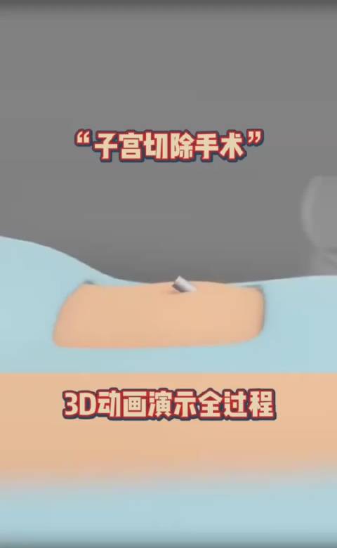 "子宫切除手术",3 d动画演示全过程!
