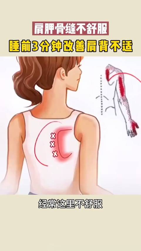 两侧肩胛骨缝不舒服一招帮你解决