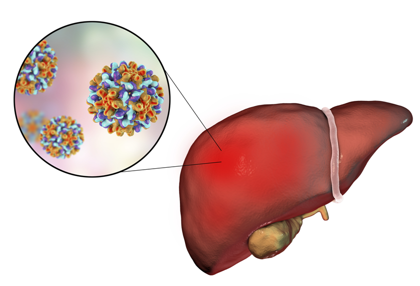 乙型流感病毒阳性严重吗 乙型流感病毒感染的风险有哪些