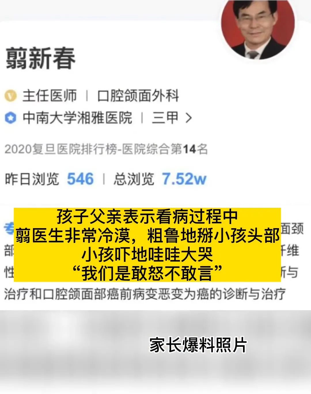 孩子嘴里出现肿块:湘雅医院诊断肿瘤,省医院棉签一拨去掉莲子壳休闲区蓝鸢梦想 - Www.slyday.coM 孩子嘴里出现肿块:湘雅医院诊断肿瘤,省医院棉签一拨去掉莲子壳休闲区蓝鸢梦想 - Www.slyday.coM