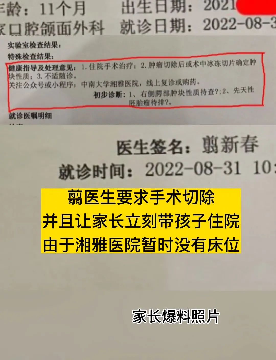 孩子嘴里出现肿块:湘雅医院诊断肿瘤,省医院棉签一拨去掉莲子壳休闲区蓝鸢梦想 - Www.slyday.coM 孩子嘴里出现肿块:湘雅医院诊断肿瘤,省医院棉签一拨去掉莲子壳休闲区蓝鸢梦想 - Www.slyday.coM