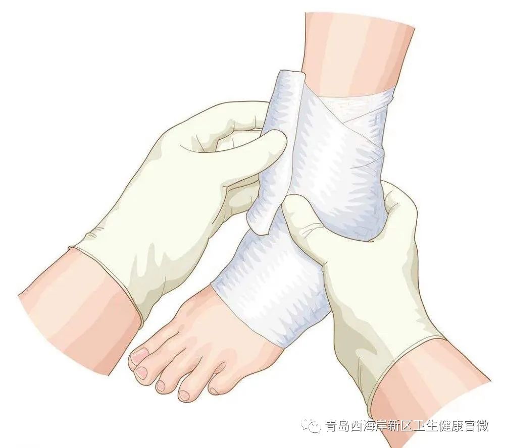 崴脚千万别大意,教您急性踝关节扭伤的处理方法|篮球_新浪新闻