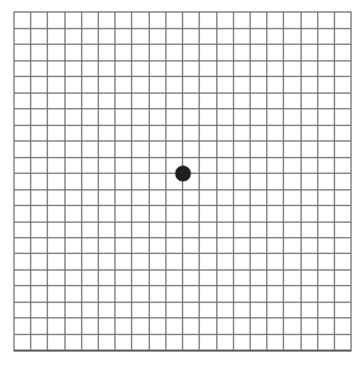 请看下面的图片:用单眼看下面的图像可以测试是否存在黄斑水肿,黄斑前