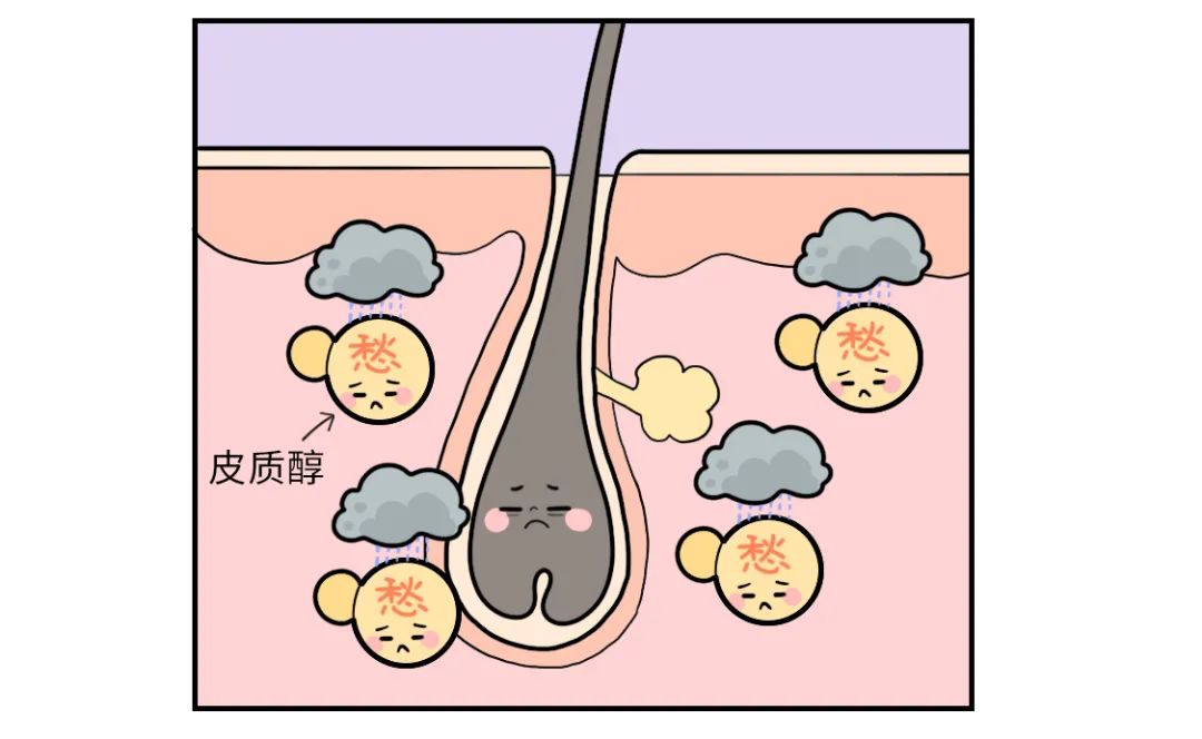 女生突然掉头发的原因找到了（不是雄脱）