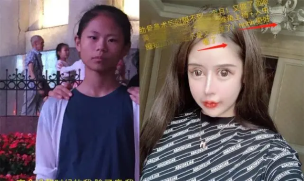 “8岁花百万整容！整容要趁早！”警惕黑医美、美丽贷和背后的手伸向越来越多的未成年人……休闲区蓝鸢梦想 - Www.slyday.coM